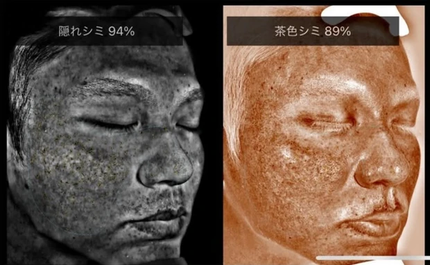 【アラサー男性体験談】メンズ美容の第一歩。VISIAで知る今のリアルな肌状態_3