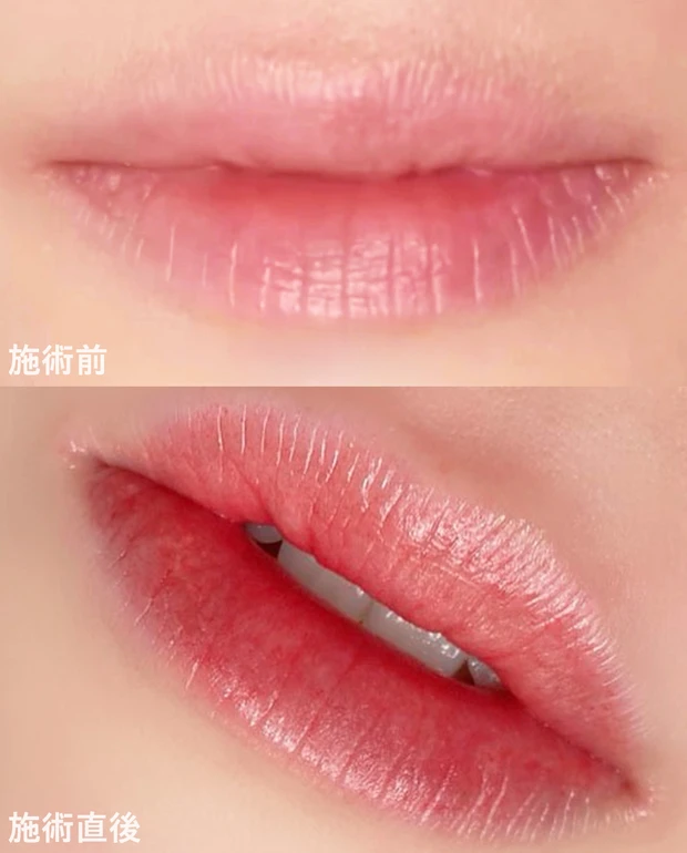 アートメイク リップ YUNOさん