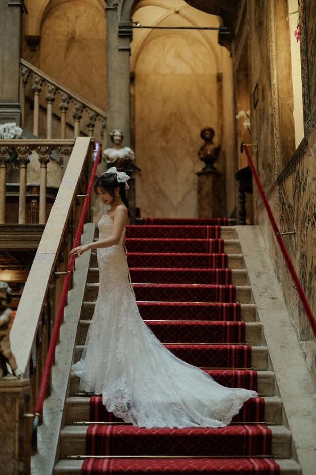 【美容医療】本当は内緒にしたいクマ取りレポート！ダウンタイムから完成まで全部お見せします！_7_1