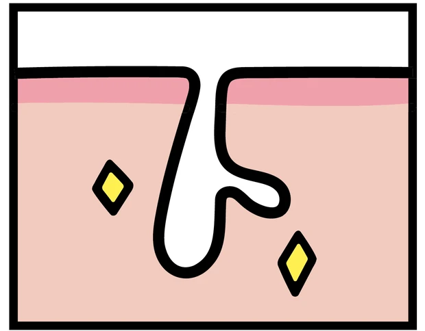 【悩み別】毛穴を目立たなくする方法 PhotoGallery_1_2