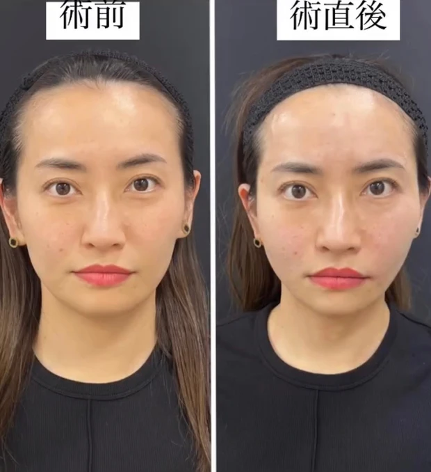 「美容皮膚科」と「美容外科」の違いについて解説します！_4_2