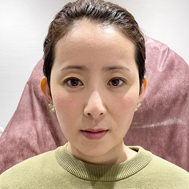 銀座レジーナクリニックおすすめ眉毛アートメイク施術内容レポ！値段は安い？MRI入れる？口コミブログ_6_1