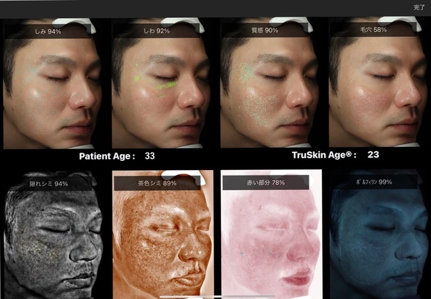 【アラサー男性体験談】メンズ美容の第一歩。VISIAで知る今のリアルな肌状態_2