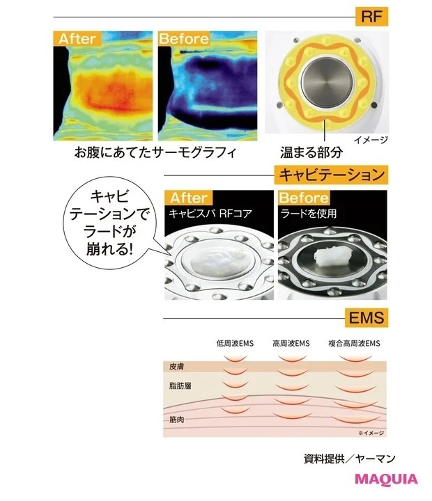 【おすすめ美容家電・美容グッズ】ヤーマン キャビスパ RFコア PLUSのメカニズム