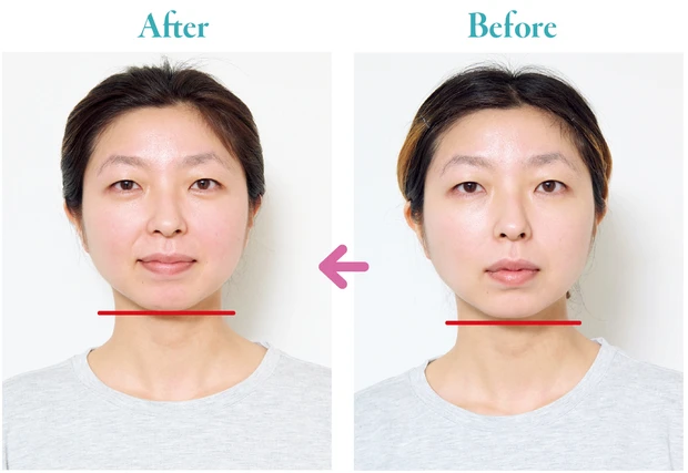 【セルフで簡単!】小顔マッサージのやり方を気になる悩み別に5つご紹介_25