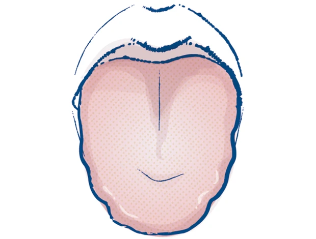 目指せ、日々快調！湿気とのつき合い方 PhotoGallery_1_19