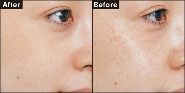 メディア コンシーラーS ナチュラルベージュ カバー力を検証