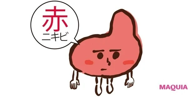 赤ニキビとは