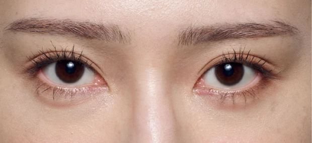 紫ぐまタイプのくまカバー＆涙袋メイクのテクニック アフター