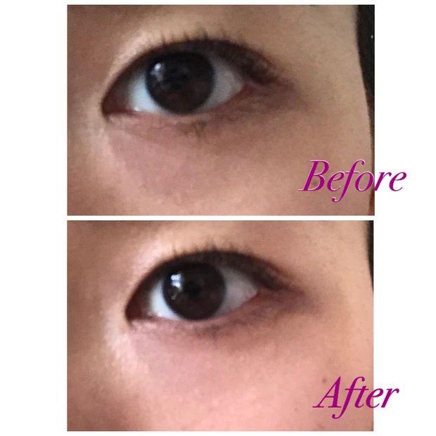 「隠す」というより「見えなくなる」RMK 優秀コンシーラー_2