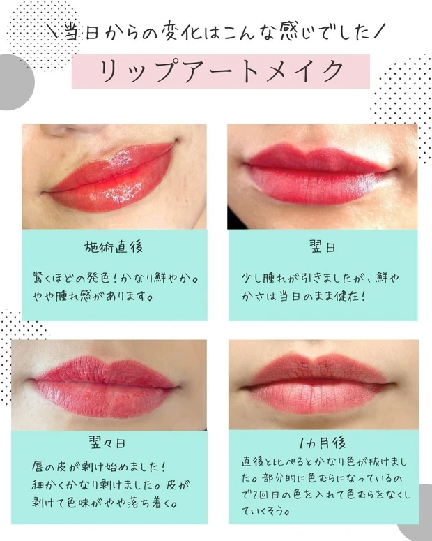 アートメイク_ダウンタイム