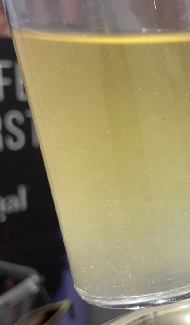 夏の毛穴汚れを洗い流せ！ハイドラフェイシャルで毛穴ツルっピカ！_4_2