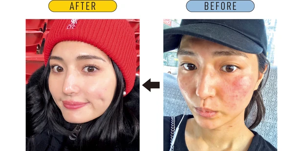 漫画で読める美肌挽回ストーリー＆おすすめコスメ PhotoGallery_1_3