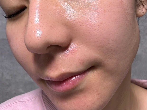 エリシスセンス ダウンタイム 1日目 経過