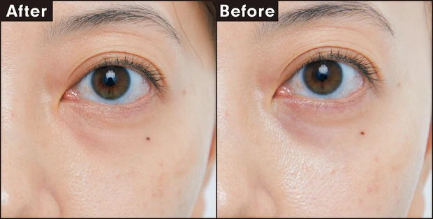 アディクション スキンリフレクト カラーコレクター 006 Warm Orange、アディクション スキンリフレクト フィックス コンシーラー 003 Fair Pink カバー力を検証