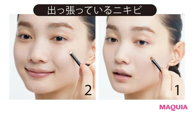 こんなときどうしたらいい? 肌作りのお悩みを解決!_Q ニキビを隠すテクが知りたい!_A ニキビのタイプ別にコンシーラーの質感を選択_1 ブラシで右下を取り、ニキビにのせる。2 スポンジチップでポンポンと優しく馴染ませ、同化させる。