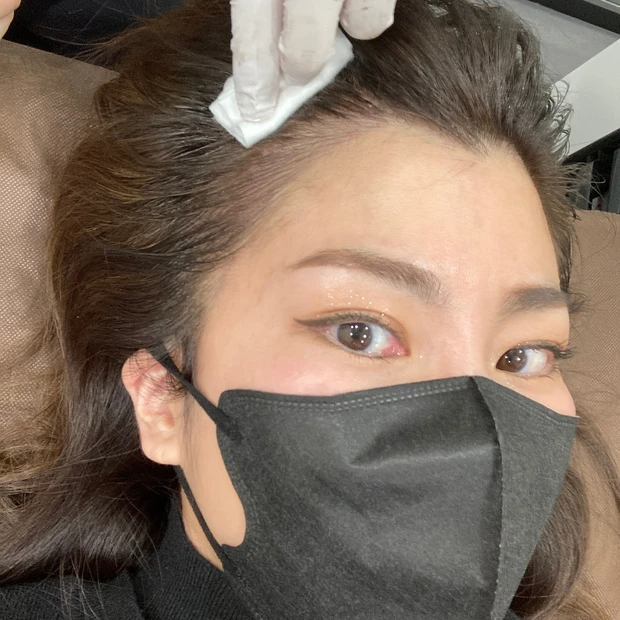 施術動画あり!ヘアラインアートメイクって知ってる?生え際のアートメイクとっても気に入ったのでレビューします!
_5_1