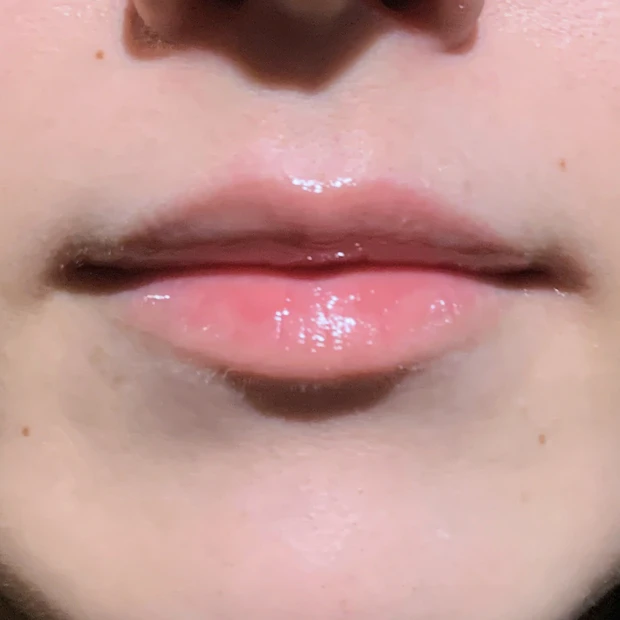 ABC−G リップセラム/ドクターケイ