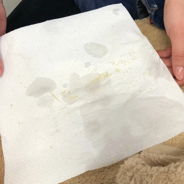 【フットケア】ガサガサかかと撃退!足裏の角質ケアはプロにお任せ_2