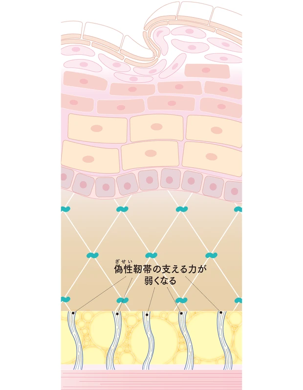 【トラブル肌のメカニズム】シミ、シワ、たるみ、乾燥、毛穴etc.におすすめのコスメ_1_31