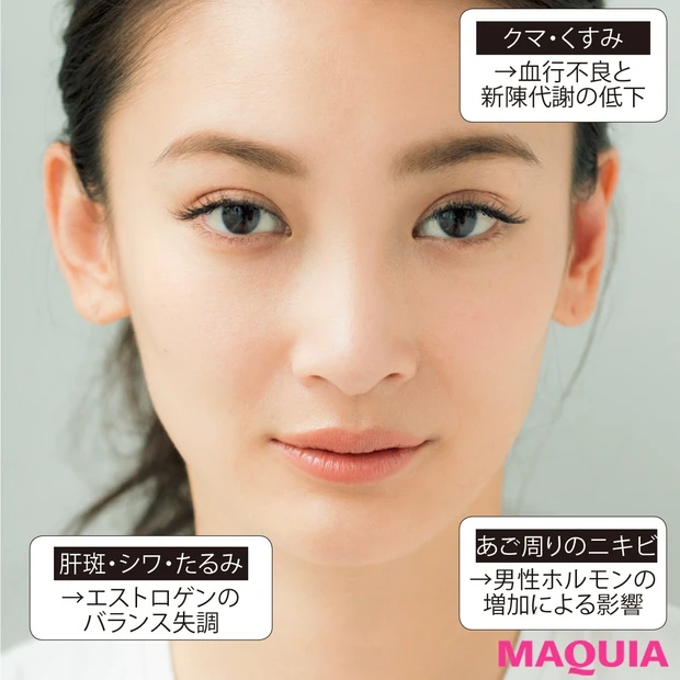 女性ホルモンと肌荒れは関係ある？ 女性ホルモンとキレイの関係を徹底レクチ…