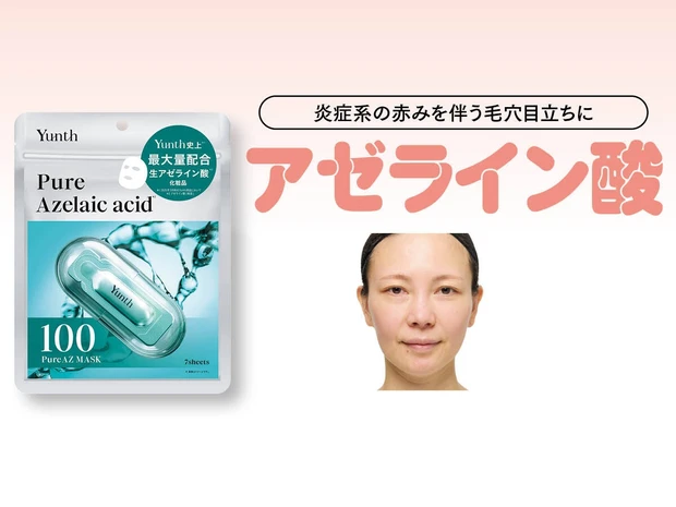 【アゼライン酸配合】Yunth(ユンス)「Pure AZ Mask」の赤み・毛穴ケア効果を検証！