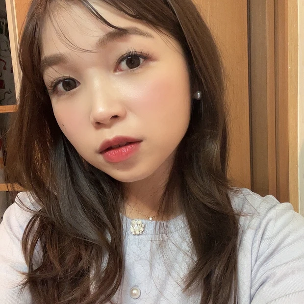 【美容医療】本当は内緒にしたいクマ取りレポート！ダウンタイムから完成まで全部お見せします！_2