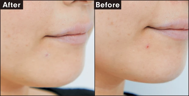 LUNA コンシールブレンダーパレット 01 カバー力を検証