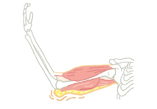 筋肉や脂肪のだぶつきがひじの上に流れつく
