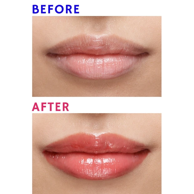 【悩み】唇が乾燥して、皮むけや荒れが気になる