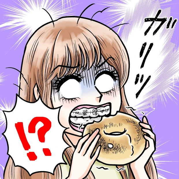 効果は? 痛い? 費用は? 実際どうなの? 【大人の歯列矯正】_9
