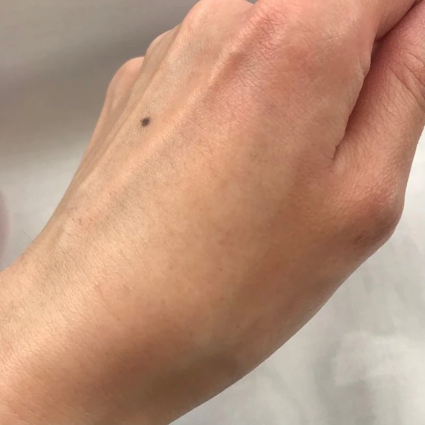 アスタリフトオプミー