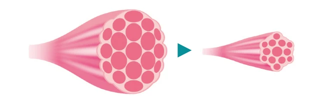 さらに加齢により眼輪筋の筋線維の数も減っていく