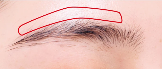 はみ出し毛の処理の方法2