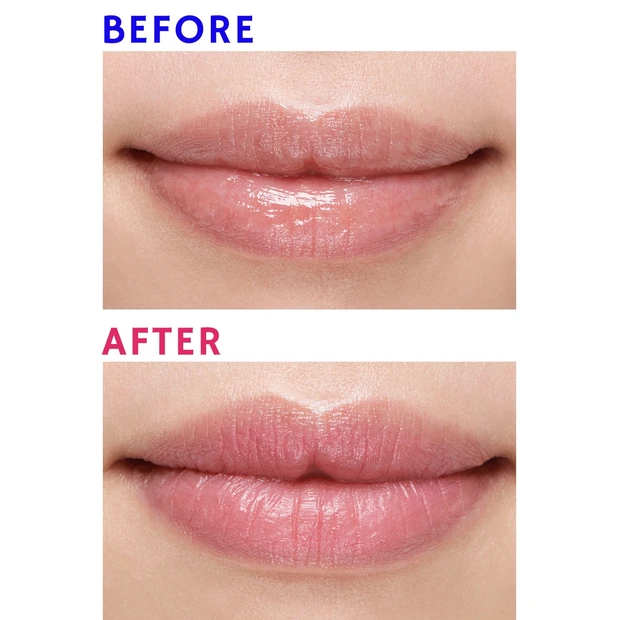 【悩み】唇が厚く、ぽってりしている