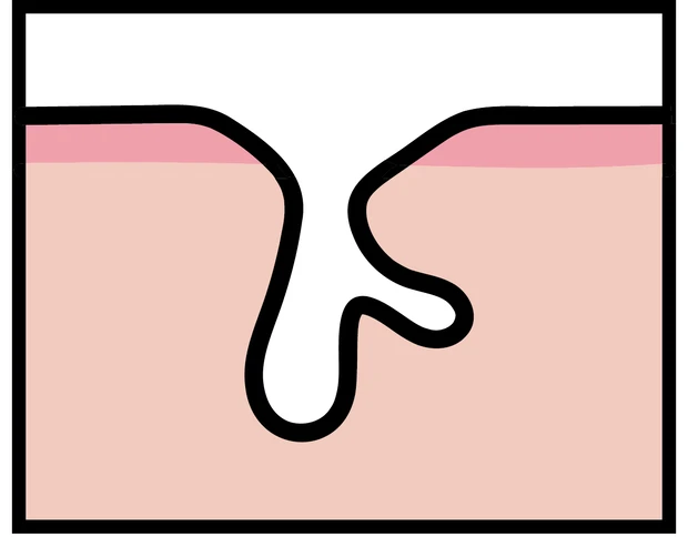 【悩み別】毛穴を目立たなくする方法 PhotoGallery_1_7