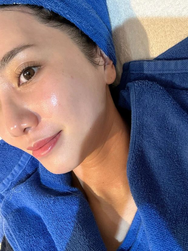 まるでむきたまご！今年やってよかった美容施術はこれ！ダウンタイムなし【𝑪𝑯𝑹𝑰𝑺𝑻𝑰𝑵𝑨 】ハーブピーリング_3