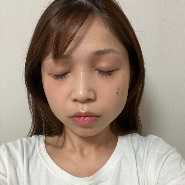 【渡韓レポ】韓国でハイフとエラボトックスして来ました（月１回×２）！！痛みは？効果は？体験談をレポートします💓小顔になりたいか方必見です！！明洞のTHE CLIM Clinicに行ってきたよ_4_1