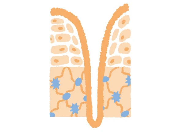 複合的な要因によって肌が萎み、シワが深まる
