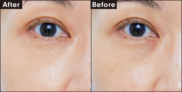 ゲラン テラコッタ コンシーラー 1N カバー力を検証