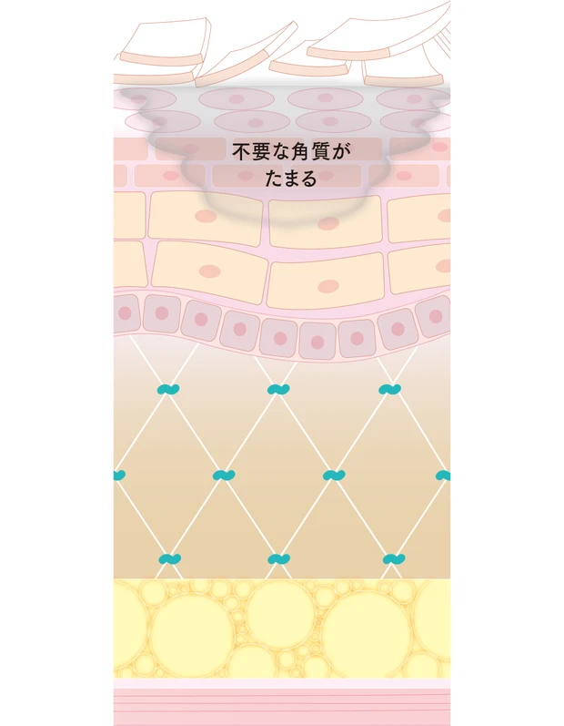 【トラブル肌のメカニズム】シミ、シワ、たるみ、乾燥、毛穴etc.におすすめのコスメ_1_3