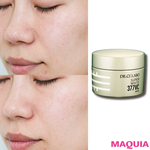 ビタミンCはすごかった! ドクターシーラボの美白クリームを30日間試して…