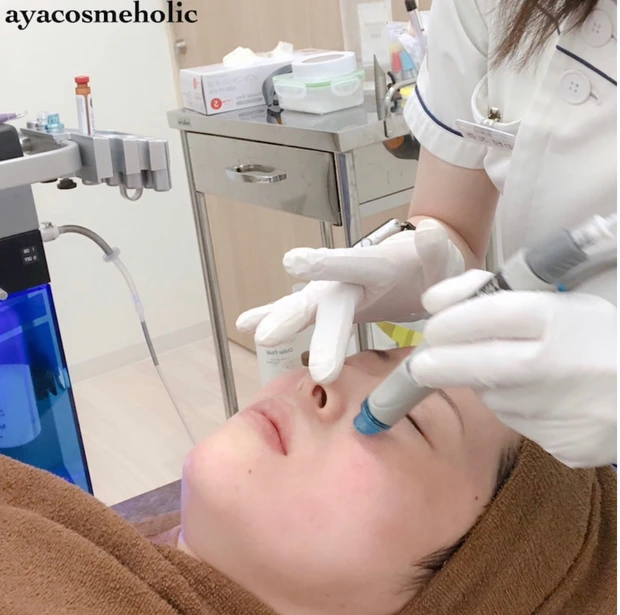 【金曜夜のぶっちゃけ美容#2】毛穴の黒ずみ開き角栓ケアあらゆることに挑戦した結果_4_1