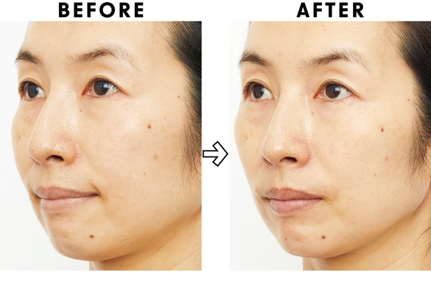 高額スキンケアの効果は？ ベスコス受賞コスメを2週間お試し PhotoGallery_1_17