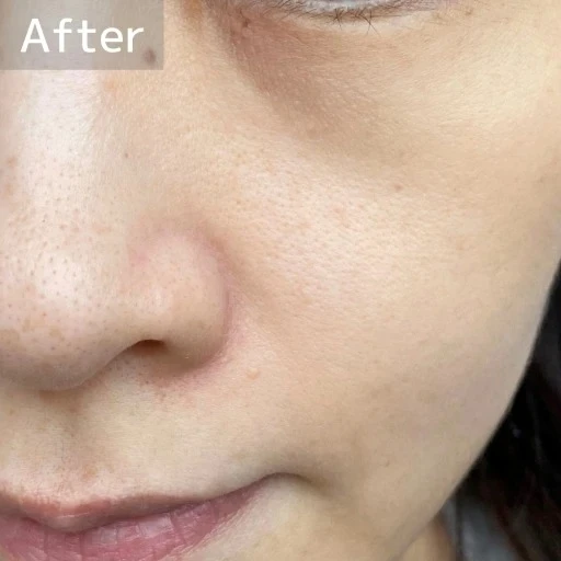 コスメデコルテ AQ 毛穴美容液オイルの口コミ 乾燥肌