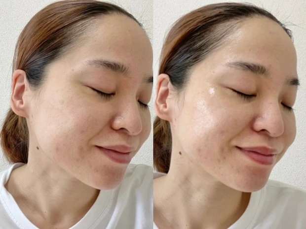 ドレススノー ローション【医薬部外品】