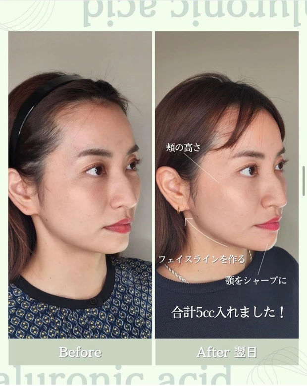 私が実践する【投資美容】3選！_1_3