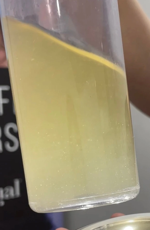 夏の毛穴汚れを洗い流せ！ハイドラフェイシャルで毛穴ツルっピカ！_4_1