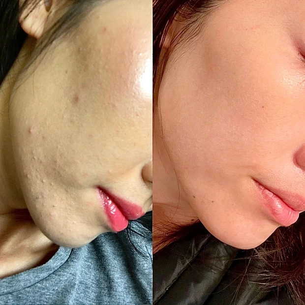 【ミスコンスキンケア講師が力説！汚肌から美肌を作る近道】世界四大ミスコン・ミスアース☆2022年度公式スキンケア講師を終えて・・・_5