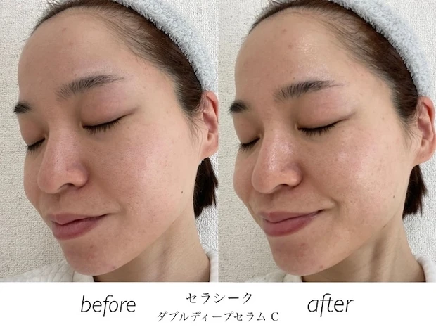 「セラシーク ダブルディープセラム C」ビフォーアフター